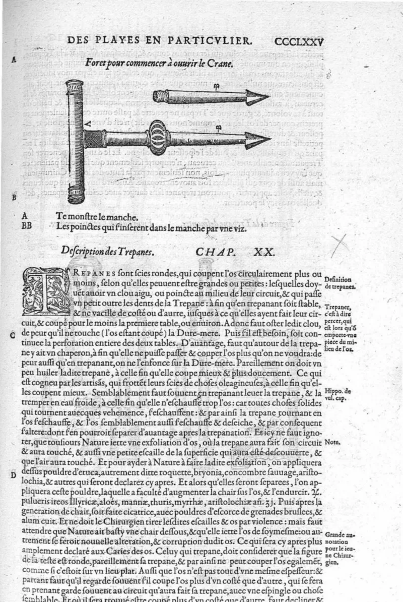 Instrumentos de trepanação: brocas e serras para abrir o crânio