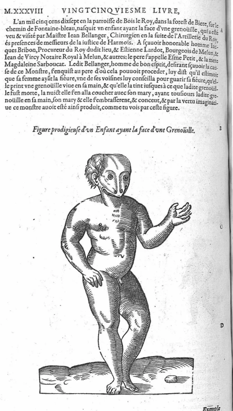 Figura prodigiosa de criança com a face de uma rã